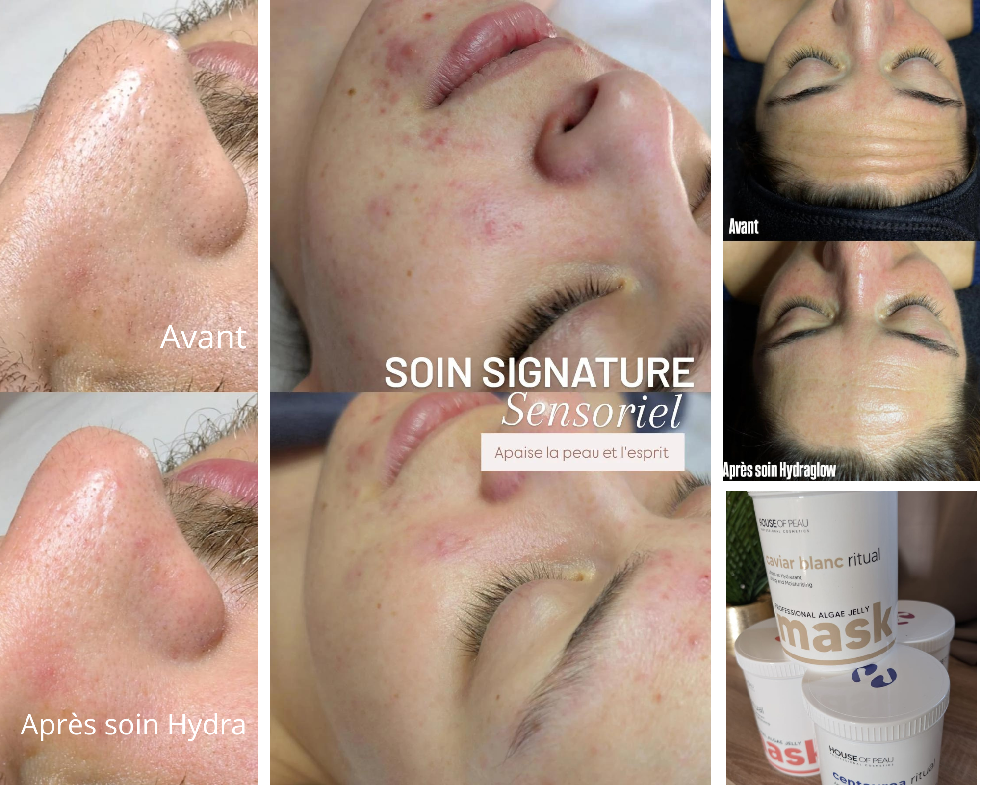soins visage hydra et soin sensoriel la teste de buch